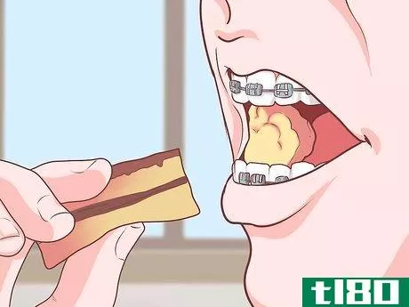 Image titled Cope With Braces As a Teenager Step 16