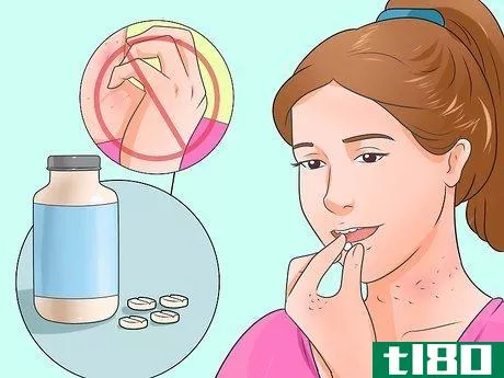 Image titled Cure Scabies Step 3