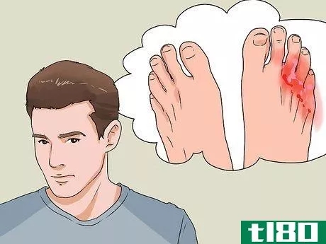 Image titled Check Feet for Complications of Diabetes Step 4