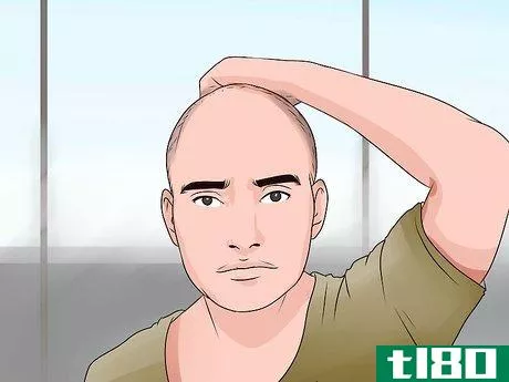 Image titled Choose the Right Hair Loss Option Step 14