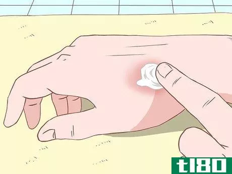 Image titled Prevent Skin Infections Step 8