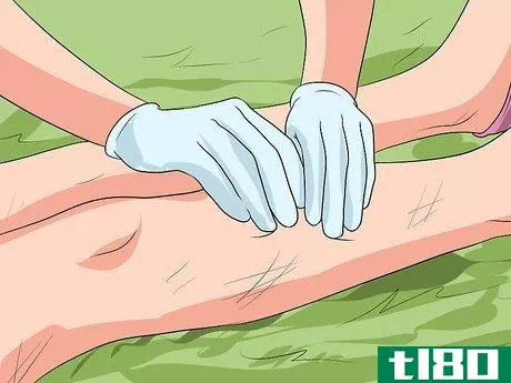 Image titled Conduct a Head to Toe Exam During First Aid Step 17