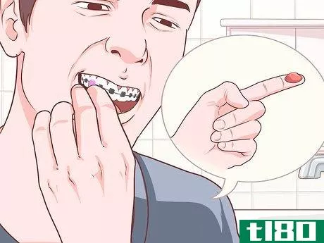 Image titled Cope With Braces As a Teenager Step 10