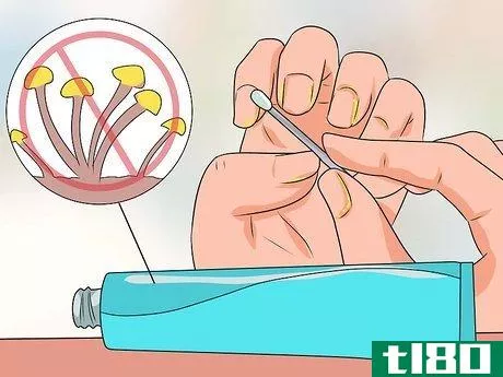 Image titled Cure Nail Fungus Step 7