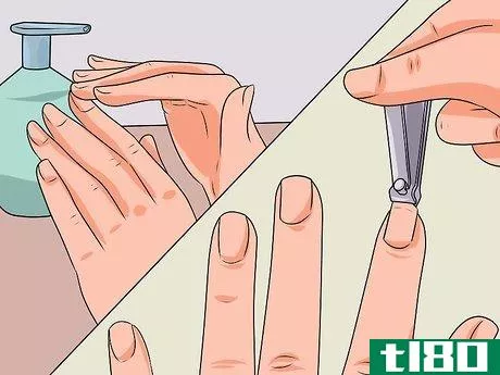 Image titled Cure Nail Fungus Step 6