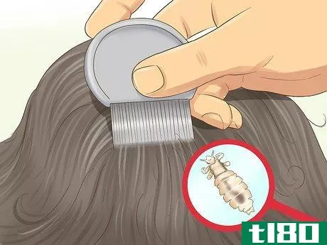 Image titled Check a Child's Hair for Lice Step 5