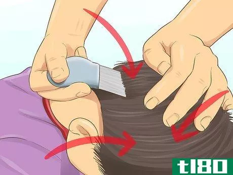 Image titled Check a Child's Hair for Lice Step 10