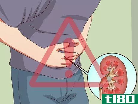 Image titled Get Rid of Kidney Stones Step 11