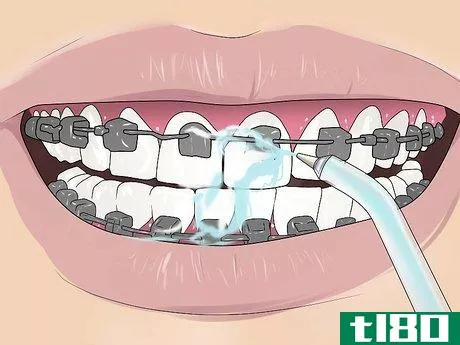 Image titled Floss With Braces Step 12