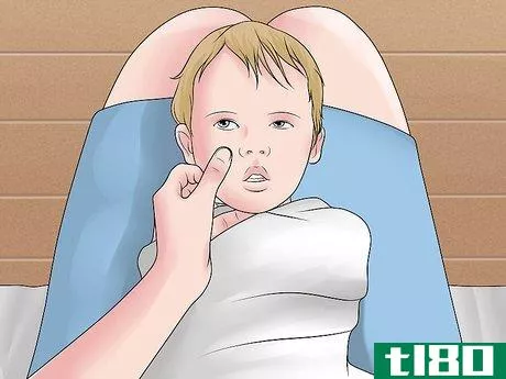 Image titled Easily Give Eyedrops to a Baby or Child Step 12