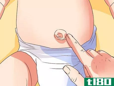 Image titled Diagnose a Child's Hernia Step 3