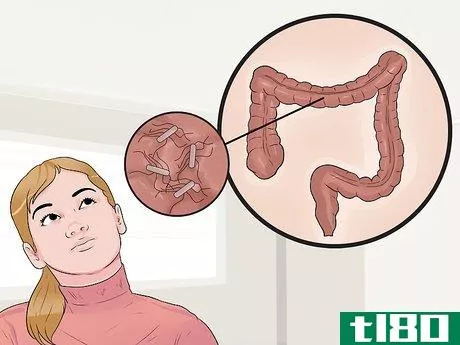 Image titled Distinguish Ulcerative Colitis from Similar Conditions Step 10