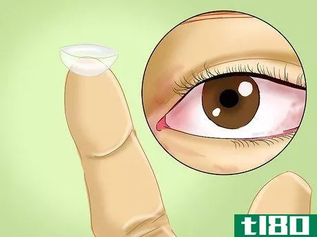 Image titled Determine if You Are Overwearing Your Contact Lenses Step 9
