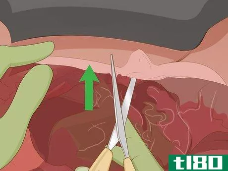 Image titled Dissect a Fetal Pig Step 13