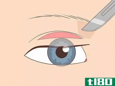 Image titled Fix Asymmetrical Eyes Step 6