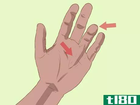 Image titled Diagnose Dupuytren's Contracture Step 2