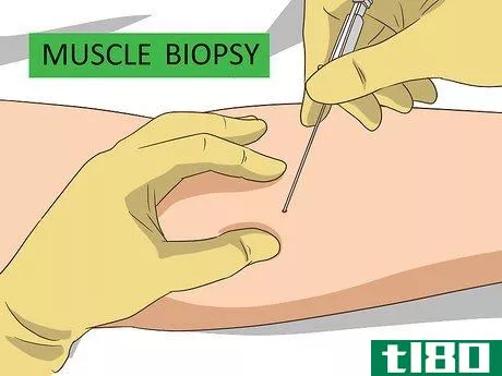 Image titled Diagnose Muscular Dystrophy Step 11