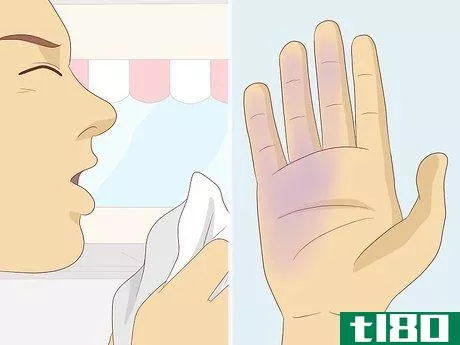 Image titled Differentiate Between the Flu and Coronavirus Step 7