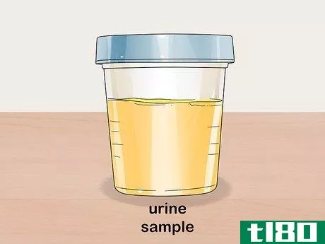 Image titled Diagnose Multiple Myeloma Step 8