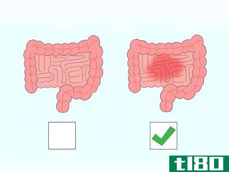 Image titled Diagnose Celiac Disease Step 4