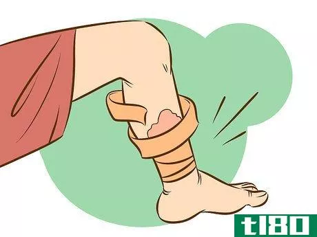 Image titled Treat Dermatitis Step 36