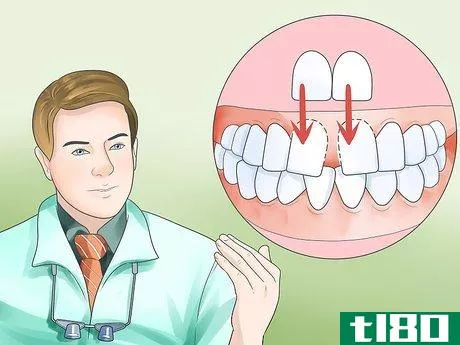 Image titled Determine if You Need Braces Step 15