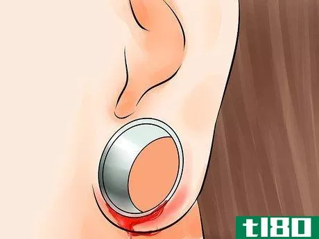 Image titled Gauge Your Ears Without Getting a Blowout Step 9
