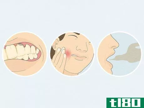 如何修复腐烂的牙齿(fix rotting teeth)