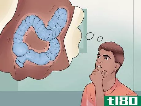 Image titled Distinguish Ulcerative Colitis from Similar Conditions Step 8
