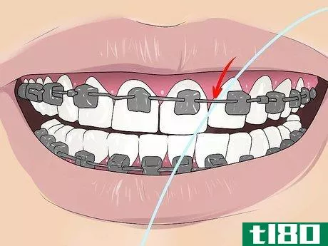 Image titled Floss With Braces Step 2