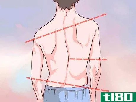 Image titled Diagnose Adult Scoliosis Step 1