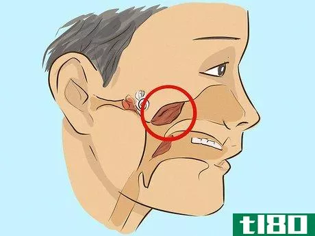 Image titled Drain Ear Fluid Step 18