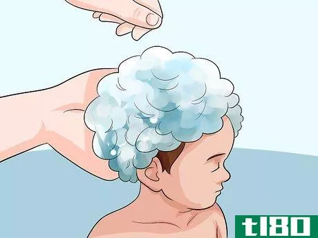 Image titled Easily Clean Baby's Cradle Cap Dandruff Without Hurting the Baby Step 6