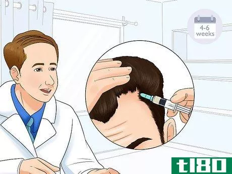 Image titled Fix a Receding Hairline Step 3