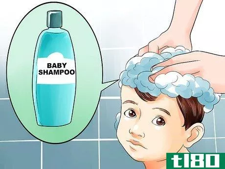 Image titled Easily Clean Baby's Cradle Cap Dandruff Without Hurting the Baby Step 2