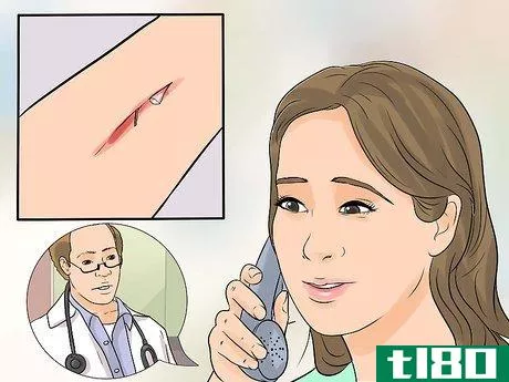 Image titled Determine if a Cut Needs Stitches Step 2
