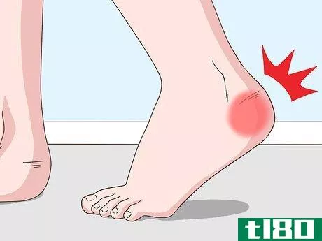 Image titled Treat Both Psoriatic Arthritis and Psoriasis Step 15