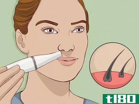 Image titled Epilate Facial Hair Step 7