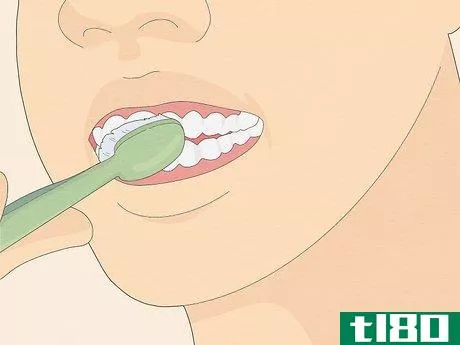 Image titled Fix Crooked Teeth Step 15