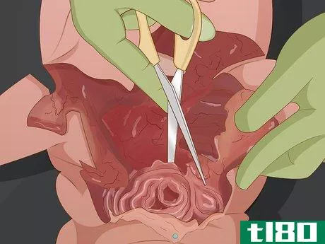 Image titled Dissect a Fetal Pig Step 14