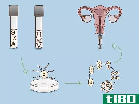 Image titled Get Fertility Treatments Step 15