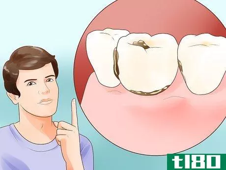 Image titled Determine if You Need Braces Step 2