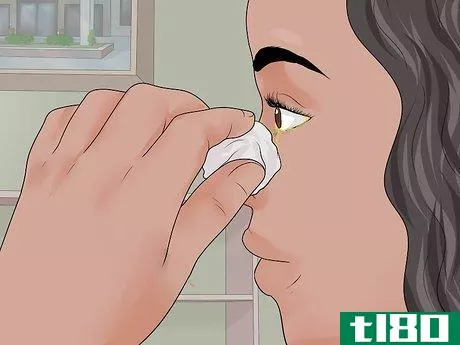 Image titled Easily Give Eyedrops to a Baby or Child Step 9
