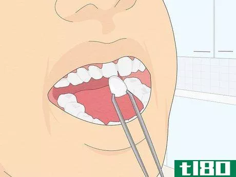 Image titled Fix Crooked Teeth Step 14