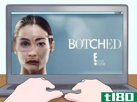 Image titled Get Cast for the TV Show Botched Step 6