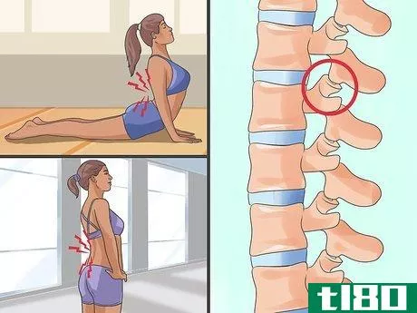 Image titled Determine the Cause of Lower Back Pain Step 8