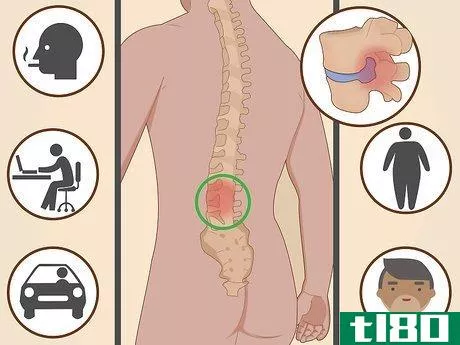 Image titled Diagnose a Herniated Disc Step 5