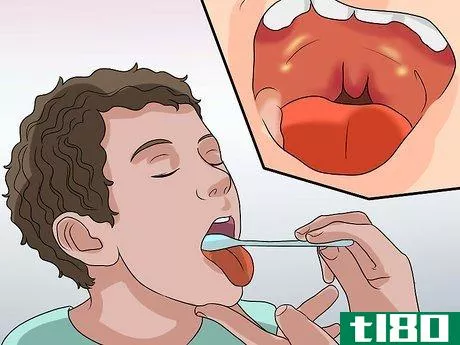 Image titled Diagnose Tonsillitis Step 3