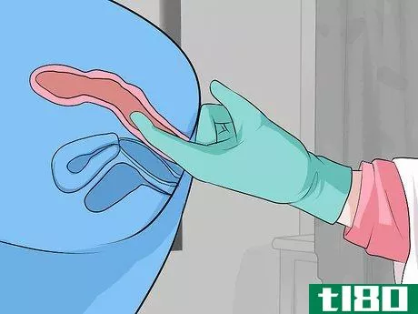 Image titled Detect Appendicitis During Pregnancy Step 13