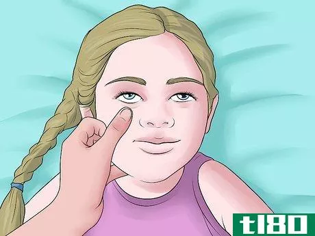 Image titled Easily Give Eyedrops to a Baby or Child Step 18